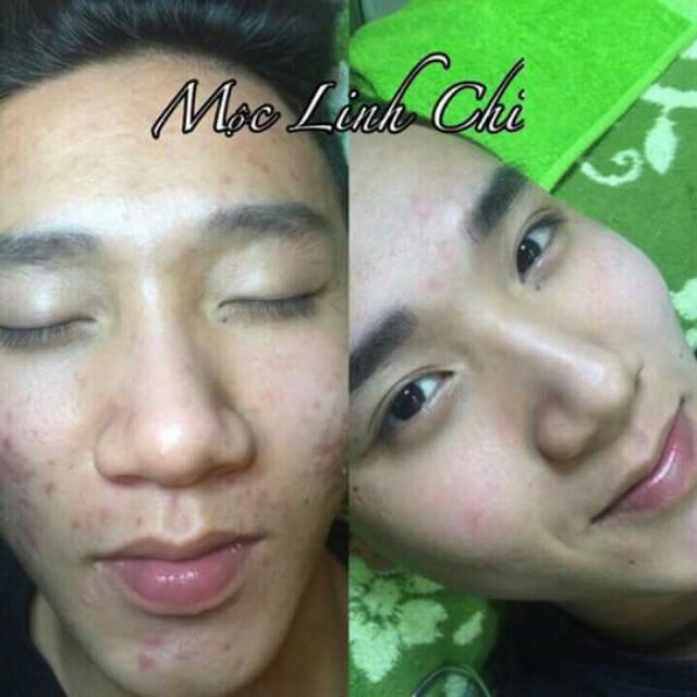 Thảo dược Mộc Linh Chi
