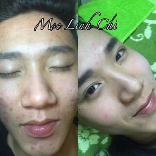 Thảo dược Mộc Linh Chi