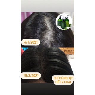 [CHÍNH HÃNG 100%] XỊT BƯỞI KÍCH MỌC TÓC