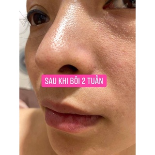 Serum mụn Dr.lannes[Tặng cây nặn mụn]
