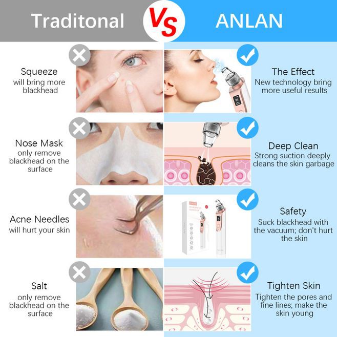 [Mã FMCGM50 - 8% đơn 250K] ANLAN Blackhead Vacuum Suction Deep Cleaner Beauty Tool
