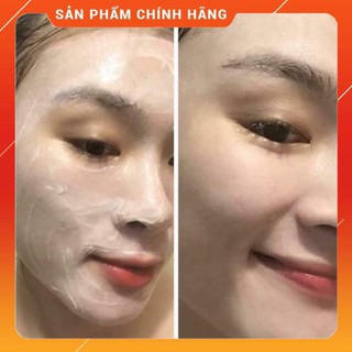 1 lọ cấy phấn Meso white