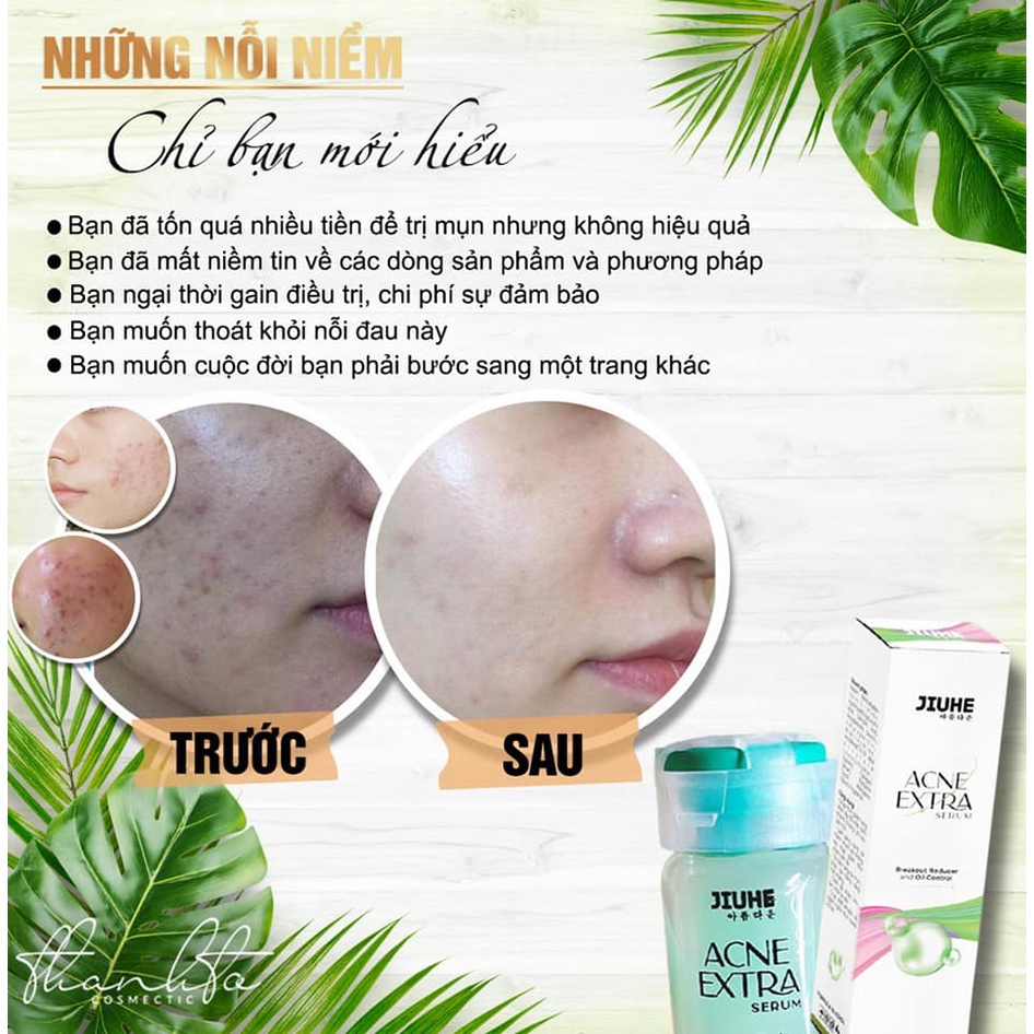 Serum mụn Jiuhe