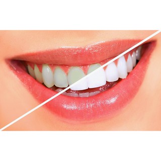Bột tẩy trắng răng Eucryl 50g (Chính hãng) Maxwell