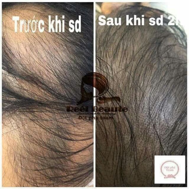 Túi lọc gội đầu thiên nhiên