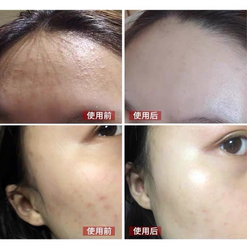 Serum Dr.Wu Mandelic Acid 18% Fullsize Fullsize