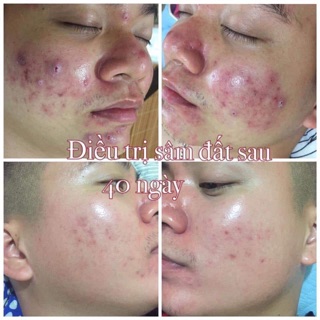 Tinh Chất Sâm Đất Dr Cell 50ml tái tạo da hỗ trợ giảm mụn hỗ trợ mờ thâm nám