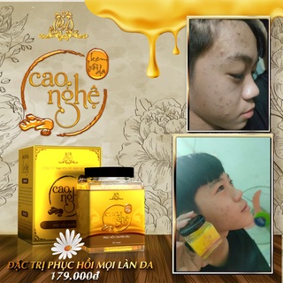 Cao nghệ phục hồi chuyên sâu Collagen X3 - Mỹ phẩm Đông Anh