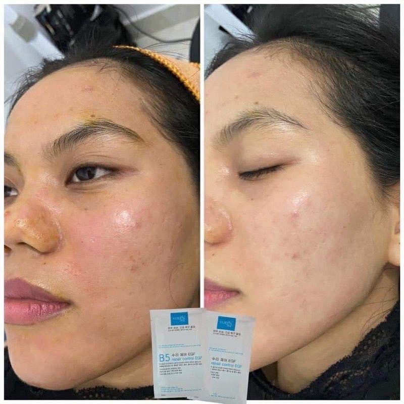 Mặt Nạ B5 YUEJIN Phục Hồi, Tái Tạo Và Cấp Ẩm Cho Da