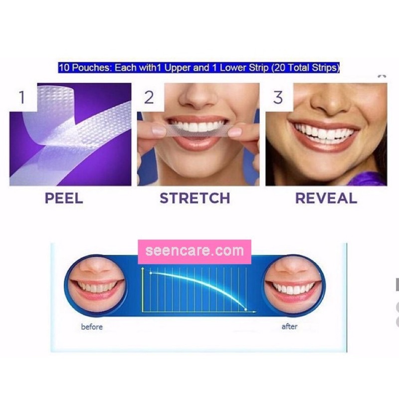 MIẾNG DÁN TRẮNG RĂNG ORAL-B 3D WHITE WHITESTRIPS ÚC (10 MIẾNG)