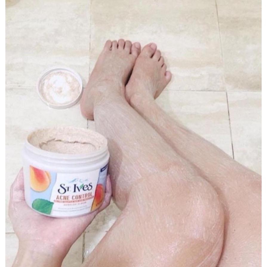 [AUTH] Tẩy da chết dịu nhẹ St.Ives 283gr Apricot Scrub hương mơ dùng cho da mụn nhờn USA | BigBuy360 - bigbuy360.vn