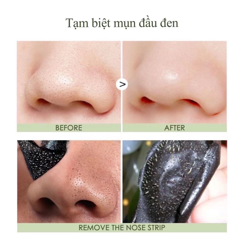 Miếng dán lột mụn HAYUE than tre hoạt tính làm sạch sâu giảm mụn đầu đen cho vùng mũi