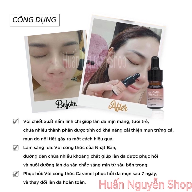 Serum giảm mụn Caramel Essence Nhật Bản , Tinh chất căng bóng , se khít lỗ chân lông to , trắng da
