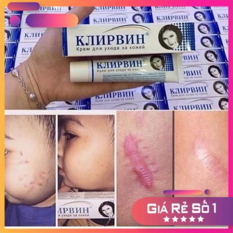 Combo 2 Hộp Kem Trị Seo Nga Hàng Xách Tay | BigBuy360 - bigbuy360.vn