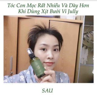 [TRỊ RỤNG TÓC 100%] Tinh Dầu Bưởi Vi Jully KÍCH THÍCH MỌC TÓC - Trị Rụng Tóc