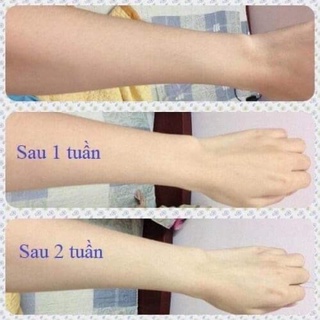 SỮA TẮM TRẮNG COLLagen x12
