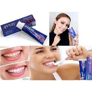 Kem Đánh Răng Crest 3D White Radiant Mint 116g Mỹ