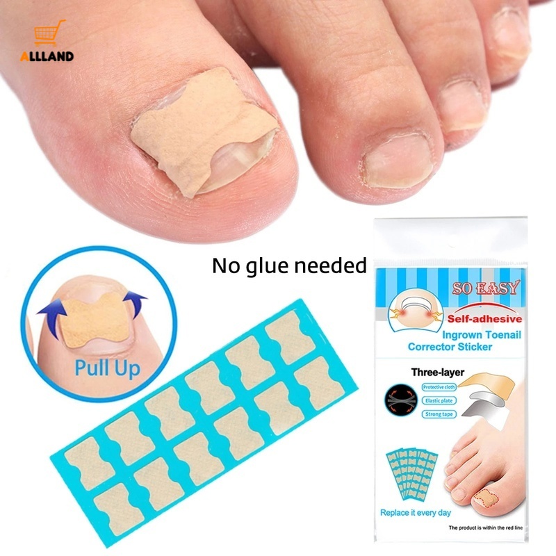 Set 36/48/60 Miếng Dán Chỉnh Hình Móng Chân Mọc Ngược