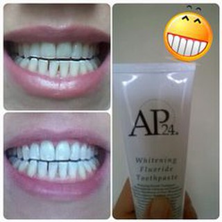 KEM ĐÁNH RĂNG AP24