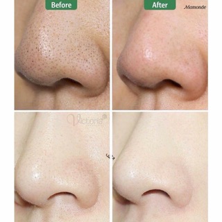 Thanh lăn MAMONDE diếp cá