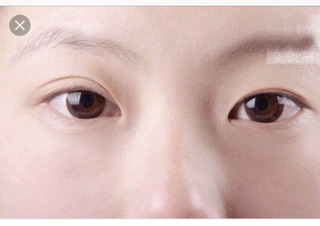 MIẾNG DÁN KÍCH MÍ 240 miếng