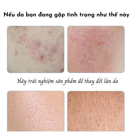combo 10 miếng giao ngẫu nhiên Mặt Nạ Trái Cây Bioaqua Mask Dưỡng Trắng Cấp Ẩm Căng Bóng- Cung Cấp Vitamin