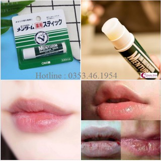 Son dưỡng môi omi menturm nhật bản chống môi khô nứt nẻ - ayakashop .mỹ phẩm nhật nội địa