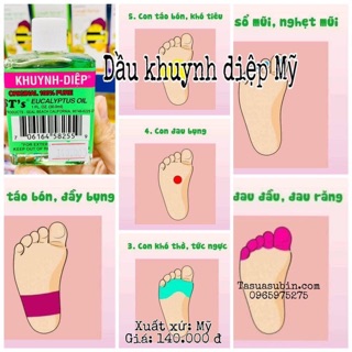 Dầu Khuynh Diệp Mỹ 30ml