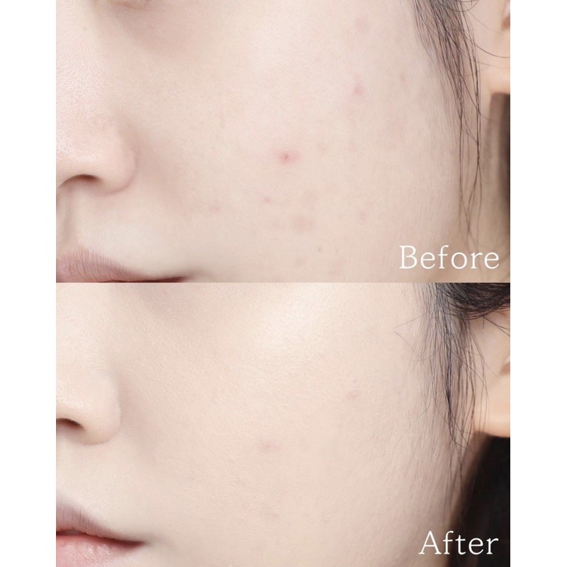 PHẤN NƯỚC ROMAND CLEAR COVE CUSHION | BigBuy360 - bigbuy360.vn