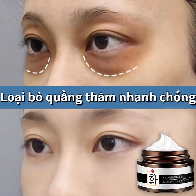 kem mắt dưỡng xóa lão hóa mắt 30g xóa nếp nhăn mà loại bỏ quầng thâm bỏ các hạt mỡ dưỡng ẩm săn chắc da mắt