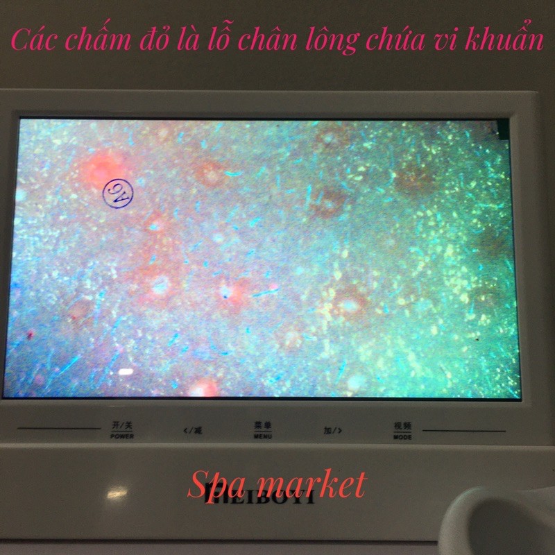 [ SIÊU SALE] MÁY SOI DA MINI IPAD 11 inch nhiều chế độ SIÊU XỊN SÒ( May soi da)