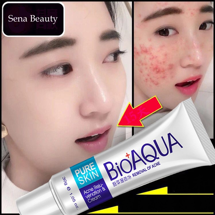 Kem dưỡng dành cho da mụn Bioaqua Pure Skin Senabeauty | BigBuy360 - bigbuy360.vn