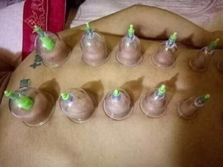 Bộ giác hơi 12 chi tiết