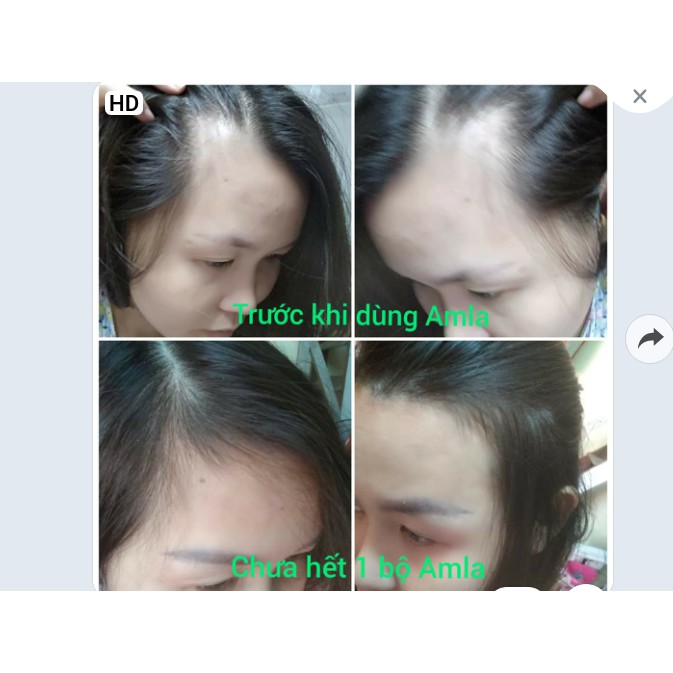 SeRum kích thích mọc tóc AMLA Của LACO