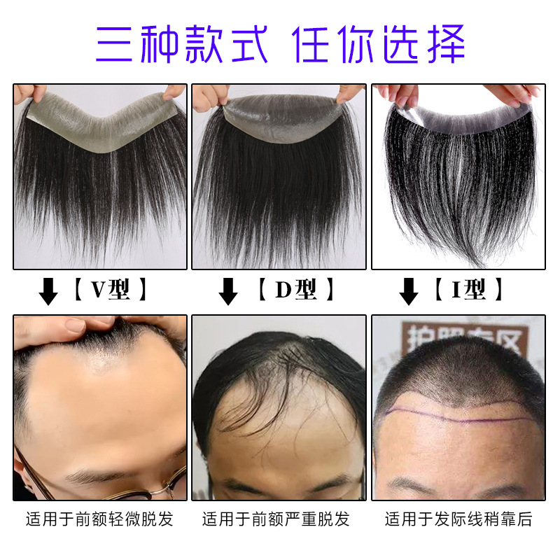 Men's hair replacement hair replacement hair wig real human scalp replacement hair piece Hand-woven bangs