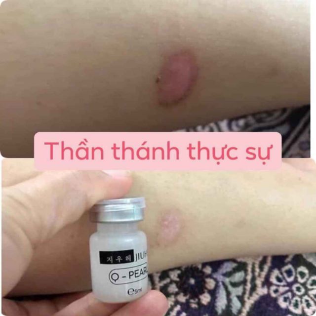 Serum JIUHE Kem Thâm , Chính Hãng