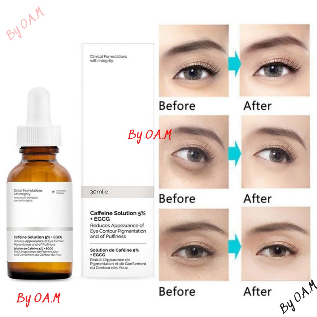 [Mã COS1904 giảm 8% đơn 300K] Serum mắt giảm quầng thâm mắt Serum Caffeine Solution 5% + EGCG Ordinary | BigBuy360 - bigbuy360.vn