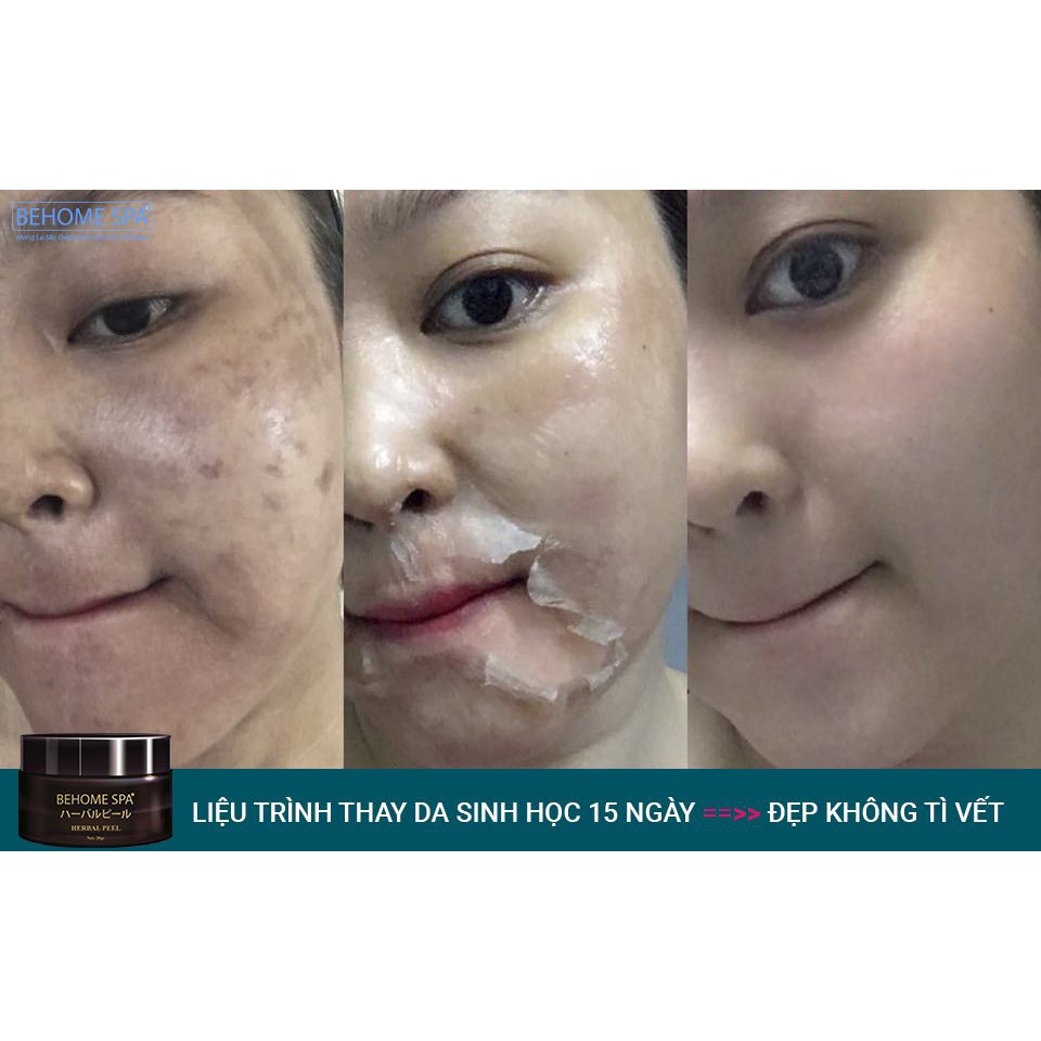 Peel da Behome Spa thay da sinh học giảm thâm mụn nám tàn nhang 20g Galaxy Beauty