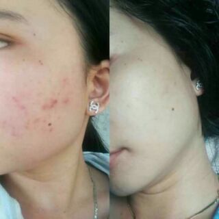 Thảo dược Mộc Linh Chi ( loại cốt )