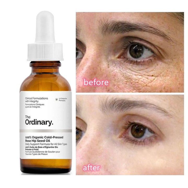 Serum dưỡng mắt The Ordinary, tinh chất giảm quầng thâm, giảm bọng mắt Caffeine Solution 5% + EGCG