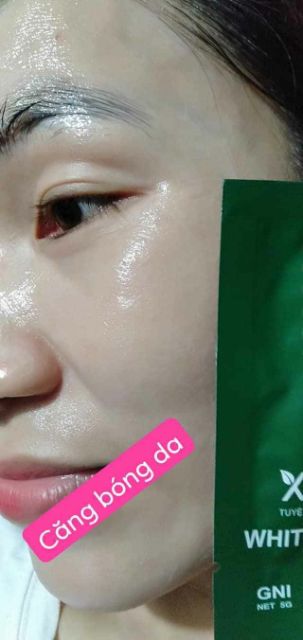 CẤY TRẮNG NÂNG CƠ | BigBuy360 - bigbuy360.vn