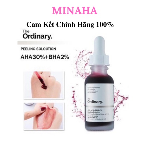 Serum THE ORDINARY AHA 30%+BHA 2% Peeling Solution Tẩy Da Chết Hóa Học Thanh Lọc Da, Dành Cho Da Mụn Thâm