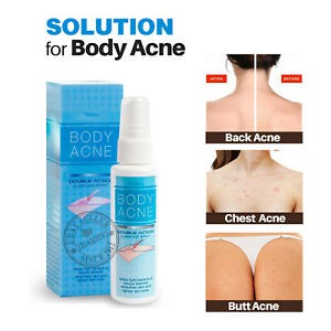 XỊT GIẢM MỤN LƯNG MISTINE BODY ACNE DOUBLE ACTION CLARIFYING SPRAY 50ML CHÍNH HÃNG - 3434