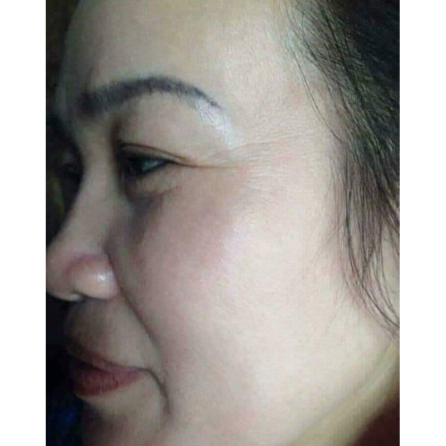 Kem Dưỡng Da💖FREESHIP💖Bộ Mỹ Phẩm Dưỡng Trắng Da Ngừa Nám YiYiMei Cao Cấp | BigBuy360 - bigbuy360.vn