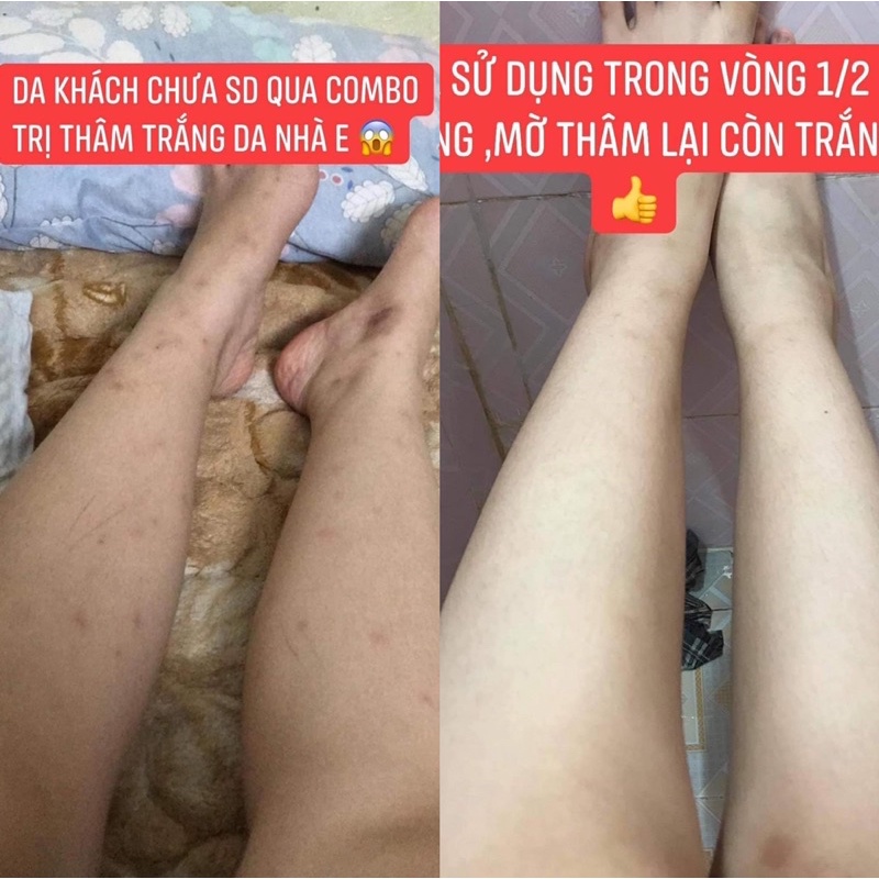 Combo 220g Kem Body Cốt Siêu Tẩy Trắng Nhanh