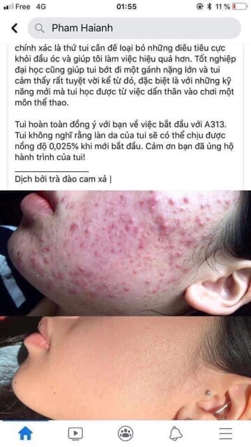 Kem ngăn chặn, giảm mụn nám tàn nhang chống lão hoá retinol A313  - Chính hãng