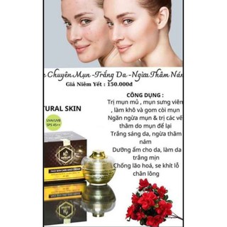 Kem mụn + trắng da + ngừa thâm nám huỳnh đỗ