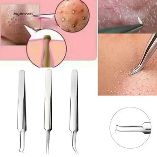 Nhíp gắp mụn đầu đen bằng thép không gỉ chuyên dụng chất lượng cao