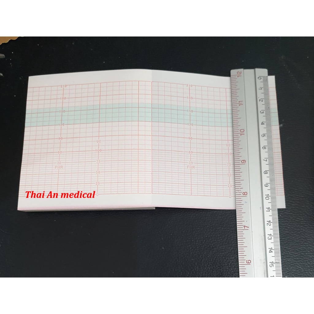 Giấy monitor sản khoa Goldway UT-3000A Edan MFM-800 sọc đỏ 112x100x150