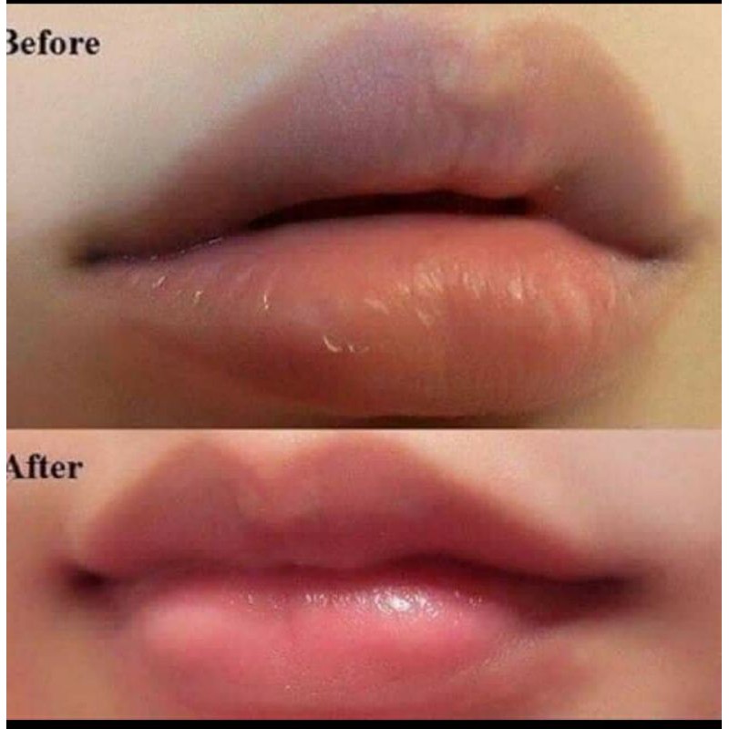 Ủ môi/Son dưỡng có màu Lips Care Thái Lan hồng môi dưỡng ẩm